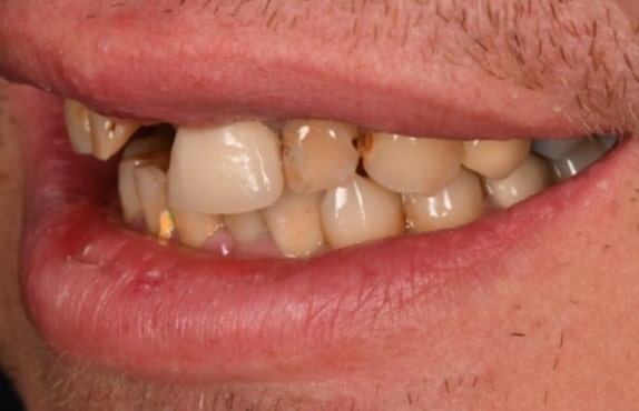 Before - Dr Mohammed Mudassar Akhtar