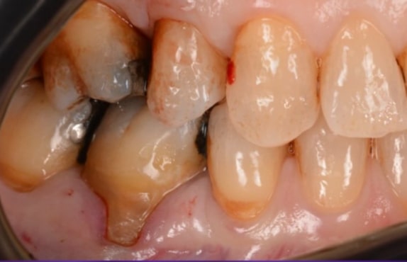 Before - Dr Mohammed Mudassar Akhtar